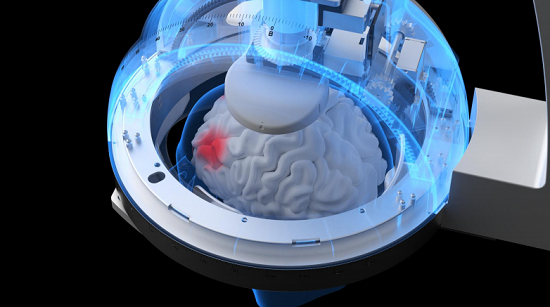 四川哪里看癲癇比較好?癲癇發作時會造成哪些危害啊?